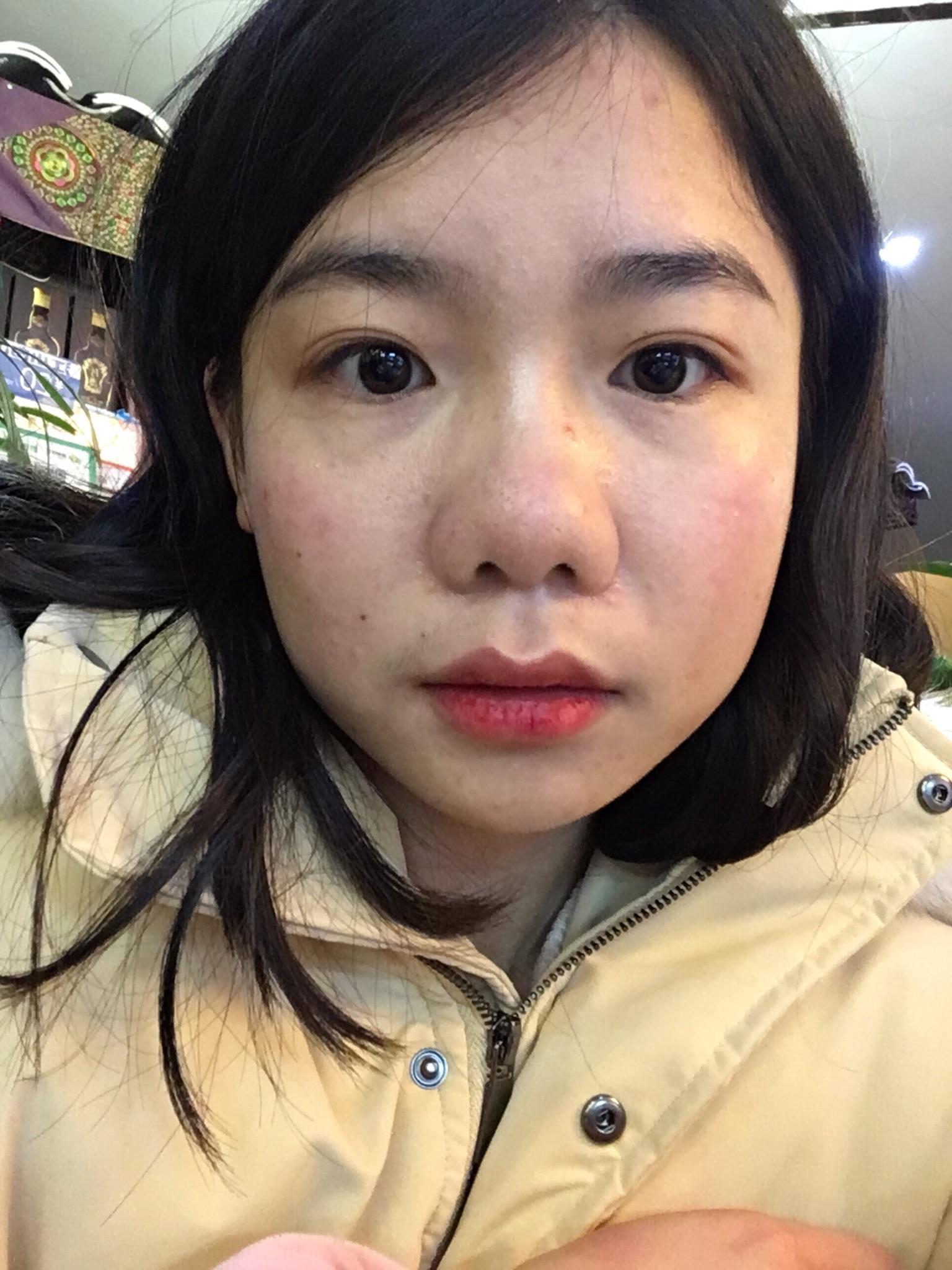 这个我觉得我有必要答一下我从小就被说鼻子不好看我妈都说等我工作