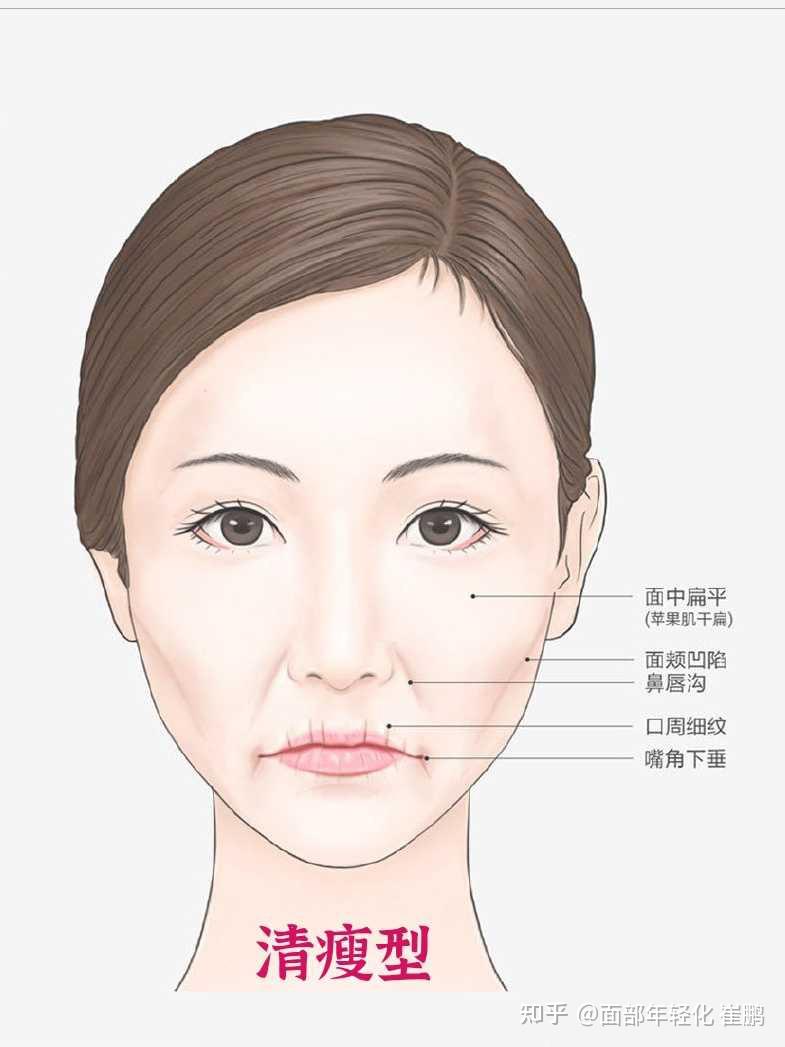 四種臉型的皮膚鬆弛下垂特點以及改善方法