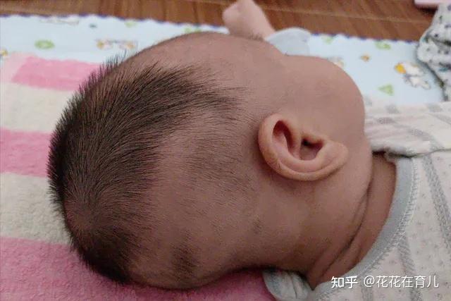 宝宝“脑勺高，聪明包”？小心睡成舟状头，后悔都来不及！ - 知乎