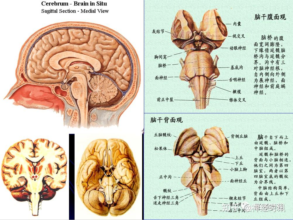 脑干腹面图图片