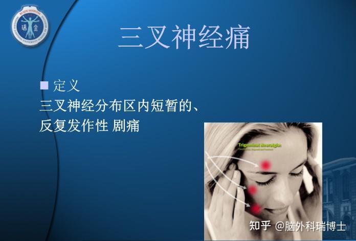 面部疼痛不一定就是三叉神经痛? - 知乎