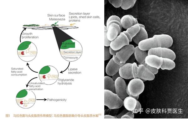 头油、头屑、脱发、敏感、毛囊炎...头皮问题反复怎么办？什么是头皮三大平衡？ - 知乎