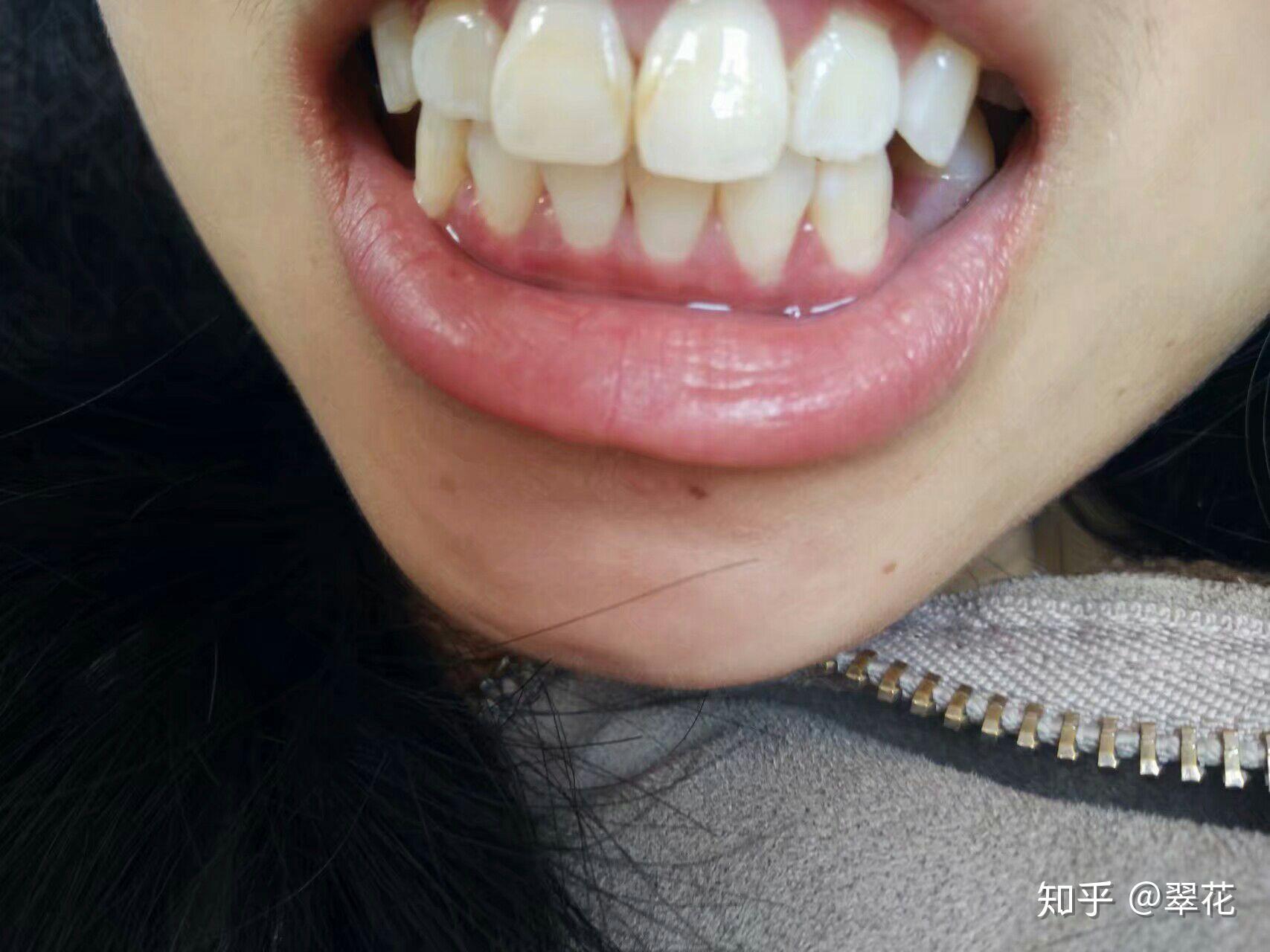 v2-8bd23ed4bb99fc2602053a16359ef40e_r.jpg