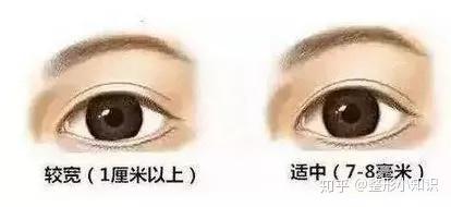 小孩怎么才能有双眼皮 v2-8c41672445f0d34b0409b2bc1c073a4a_b.jpg