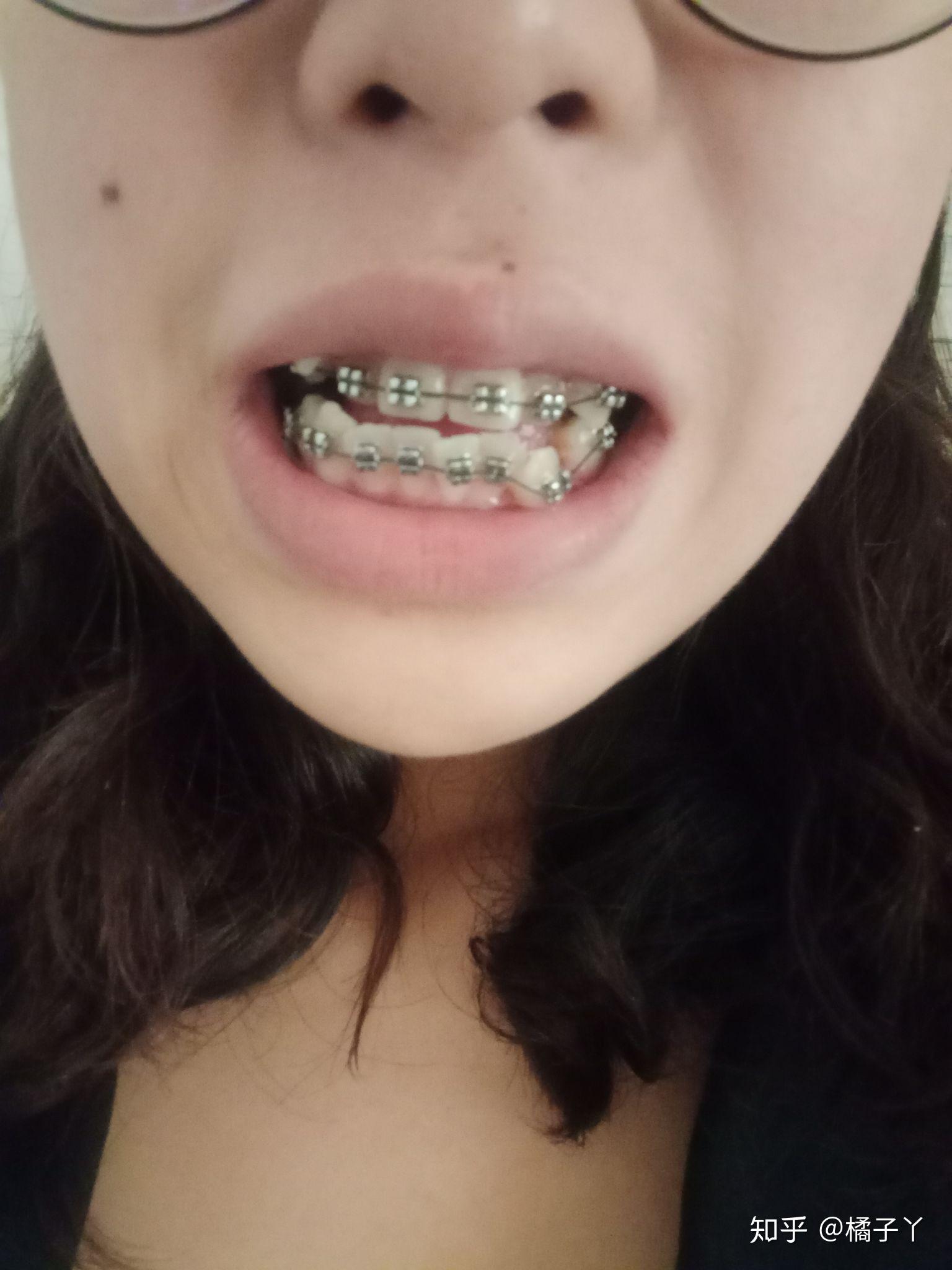 v2-8cc4deeebbeffccc06efe47a26e193ca_r.jpg