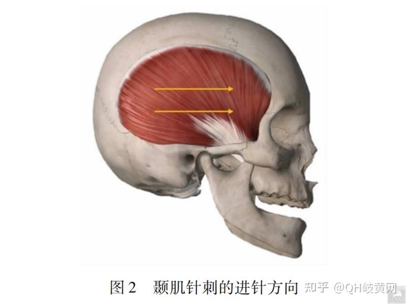 动筋针调节颞下颌关节的解剖学机制及其针法的应用 - 知乎