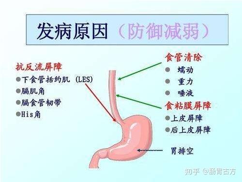 胃反流症状早期图片