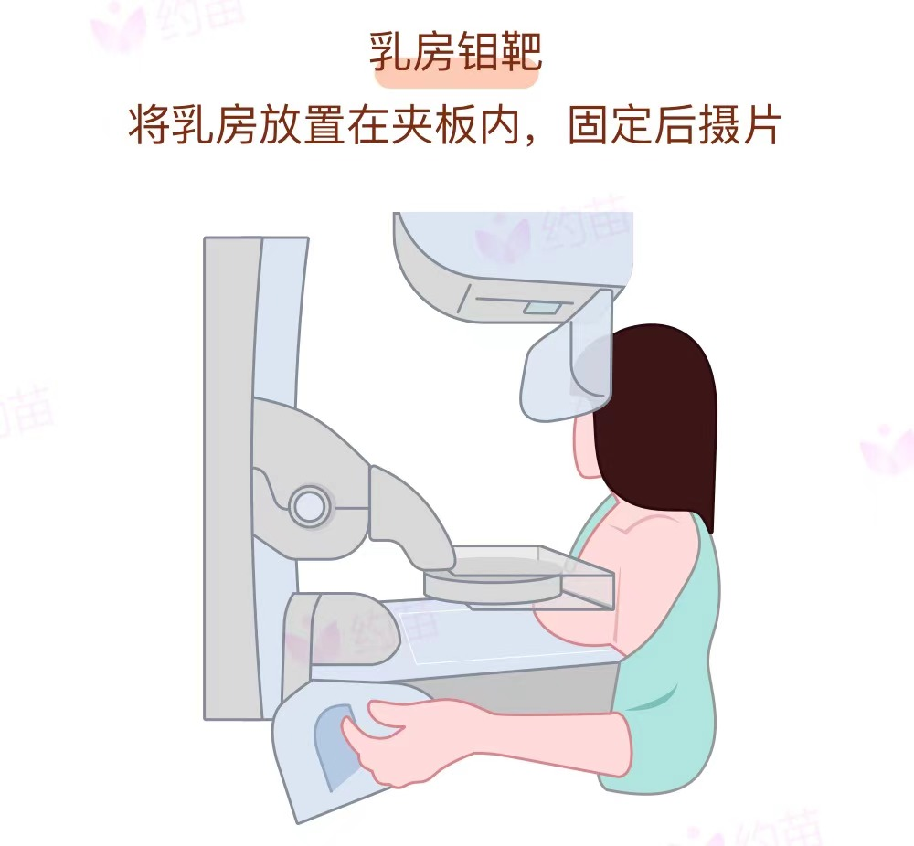 乳腺钼靶b超mri胸部检查到底怎么做