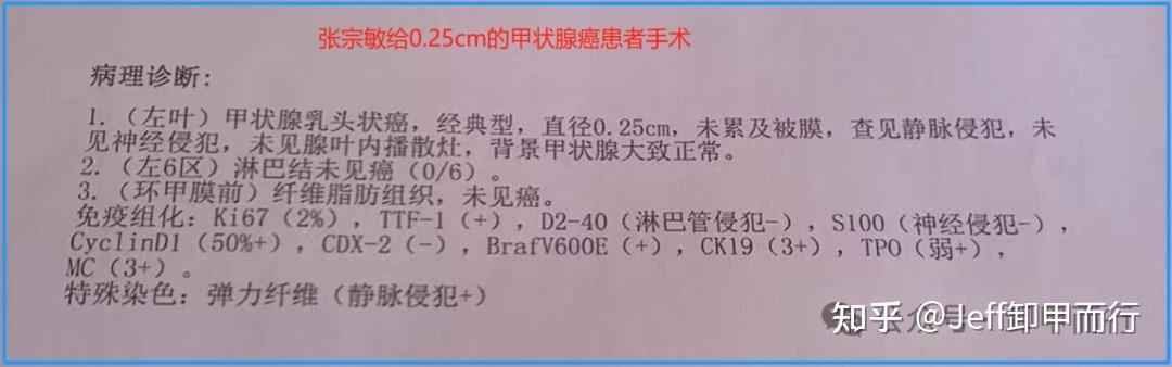 张宗敏上央视,怎么突然变老实了? - 知乎
