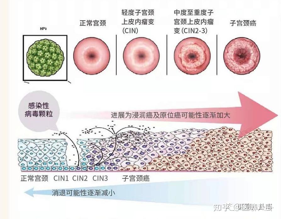 宫颈组织结构分层图片