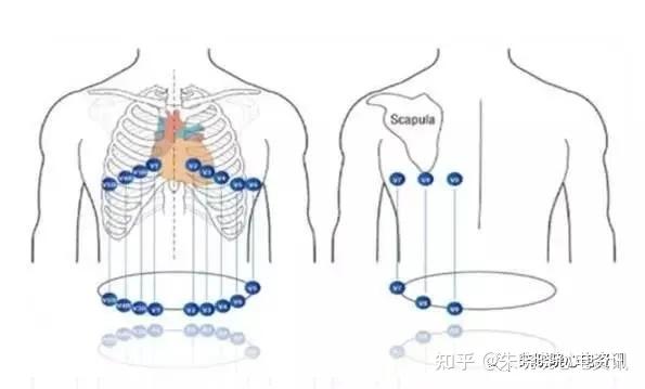心電圖導聯繫統有哪些心電圖導聯是指探查電極(電極板)放在身體的部位