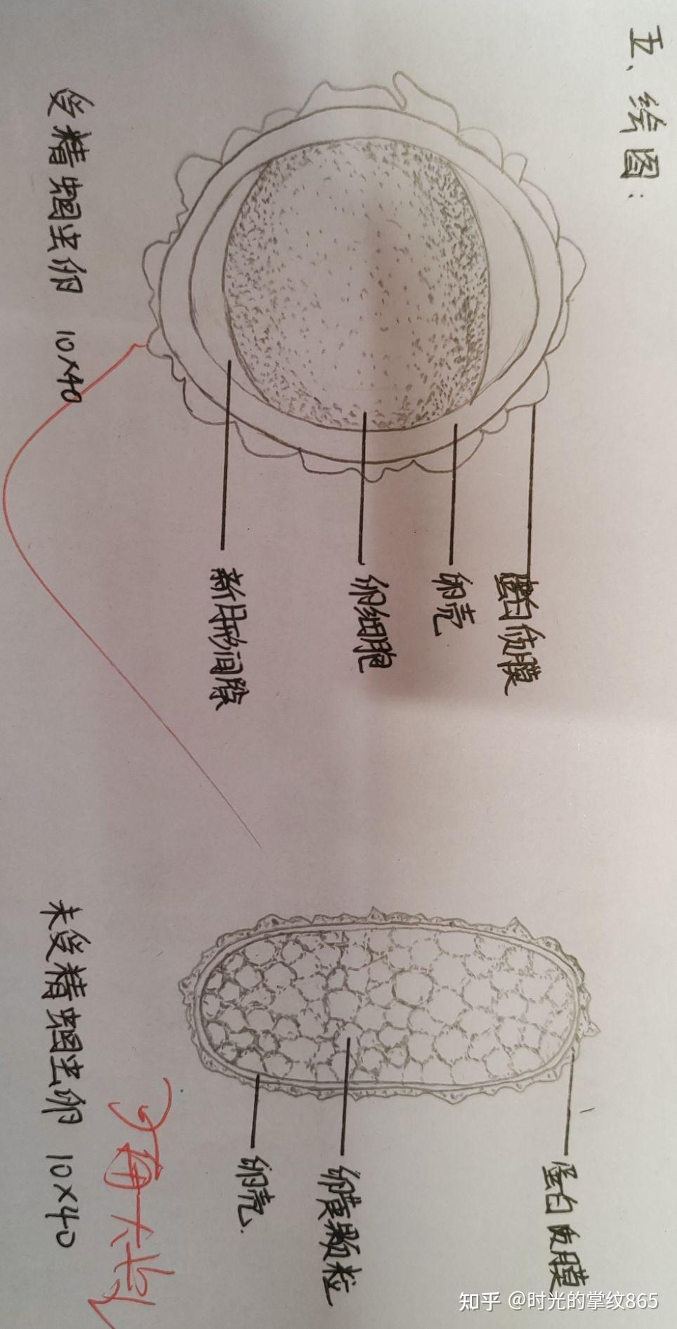 胰阔盘吸虫结构图片