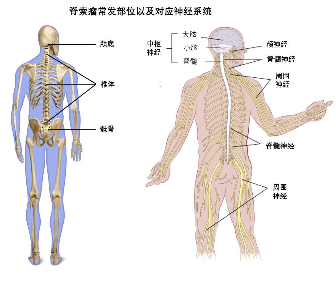 关键信息脊索瘤发病率非常低(1/1百万人,起病隐匿,解剖结构复杂