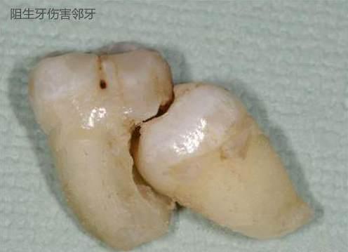 v2-8ebfcae936b045eae89d4243779a9e7c_1440w.jpg?source=172ae18b