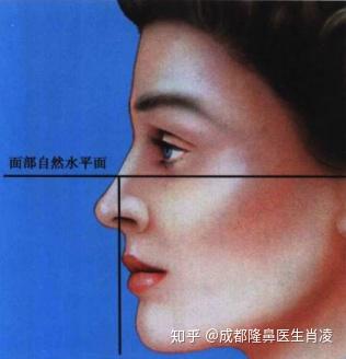 专业面部美学分析（正面+侧面） - 知乎
