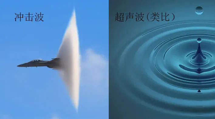脚疼用体外冲击波,还是超声波? - 知乎