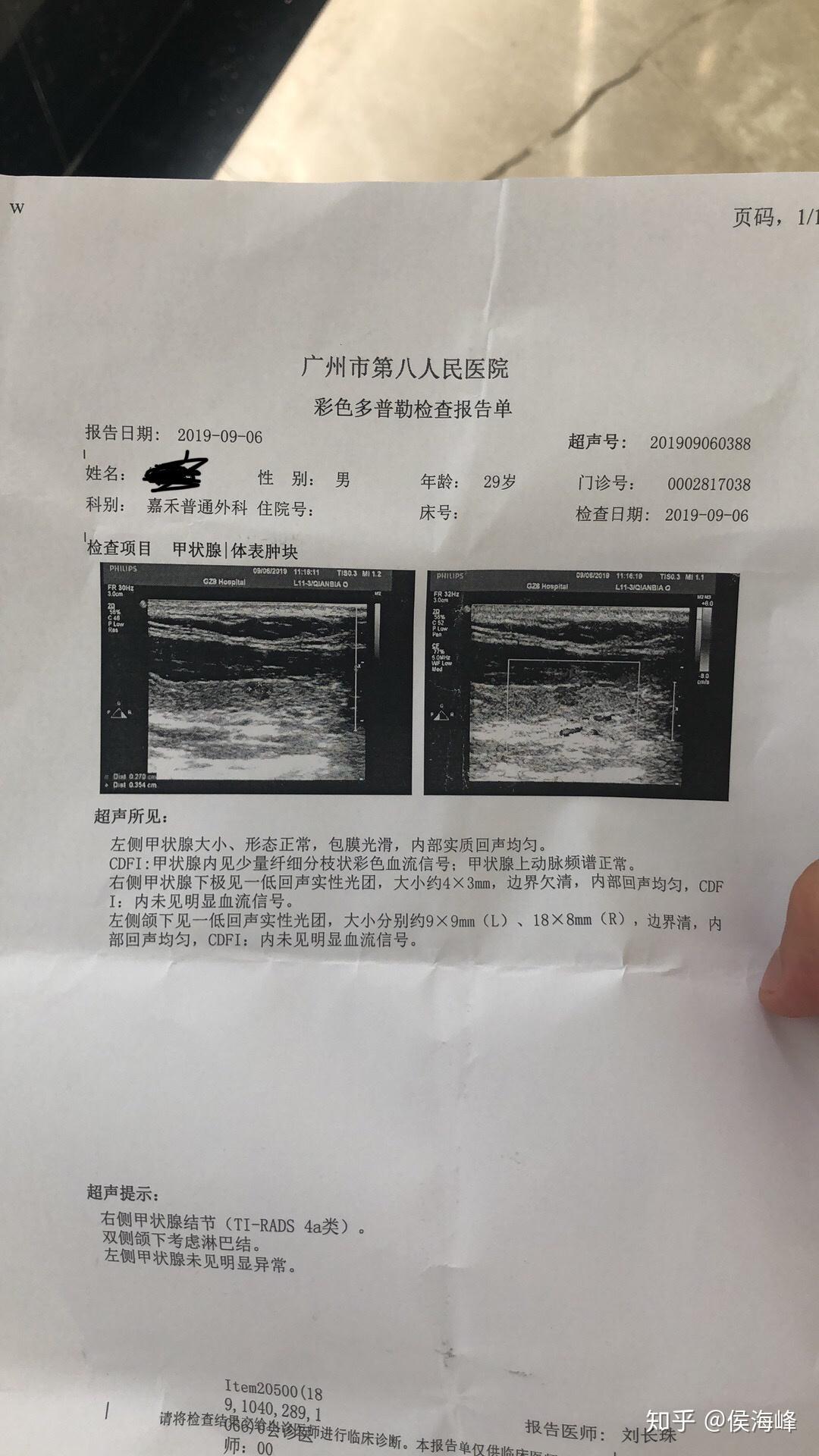 求助专业医生帮我看下这个甲状腺病理穿刺报告和b超报告