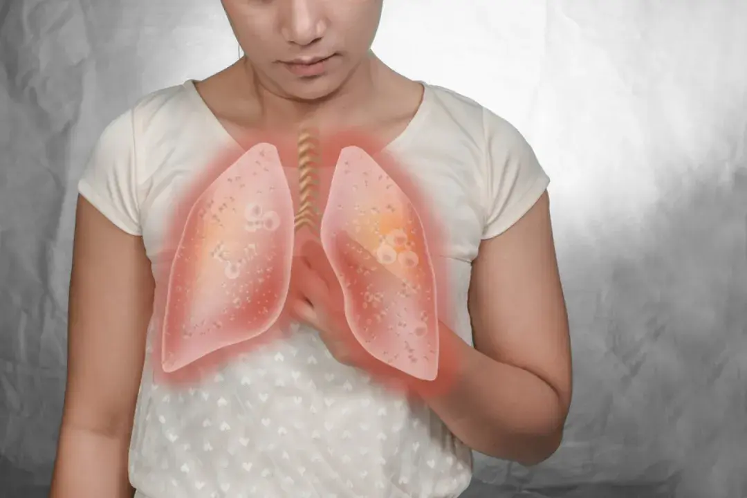 肺疼是什么原因肺部图片