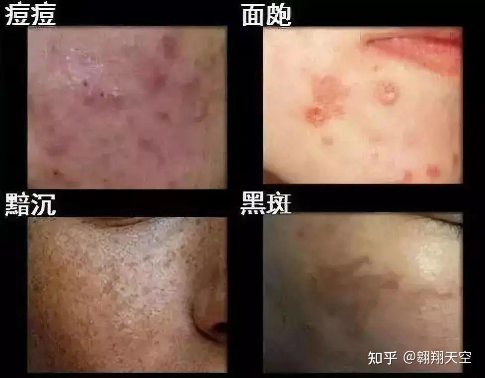 科普知识 | 经皮毒的危害有多大？看完触目惊心···看看家里的日用品是否含有它？ - 知乎