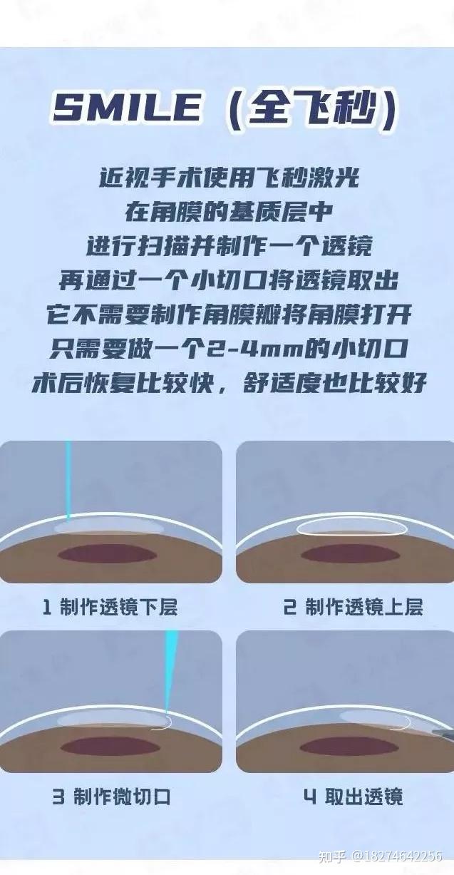 其中激光角膜屈光手术是通过激光切削一定厚度的角膜组织,改变角膜的