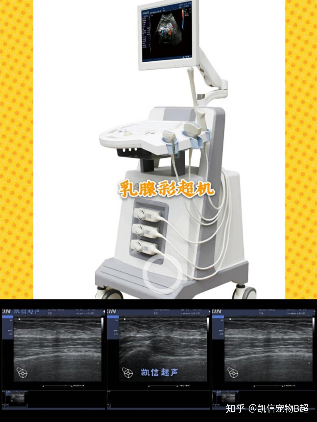 乳腺X线摄影及彩超对结构扭曲病变的诊断效能比较