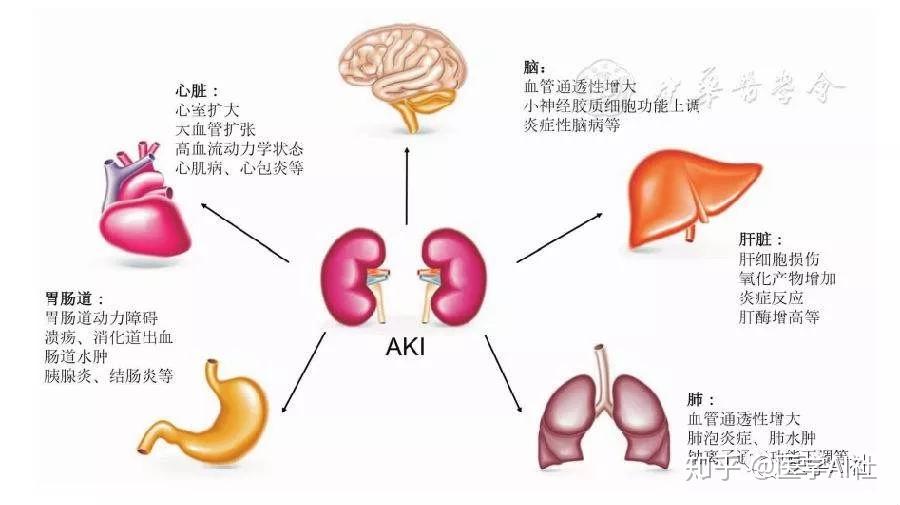 nature解讀丨基於遞歸神經網絡的急性腎損傷進展預測模型