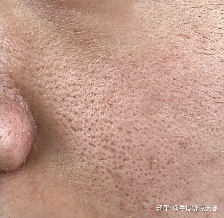 混油皮适合用精华吗?混油皮精华推荐哪些?最好用的5款精华排名 - 知乎