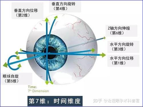 做近视眼手术阿玛仕500e,750s,1050rs设备有什么区别?