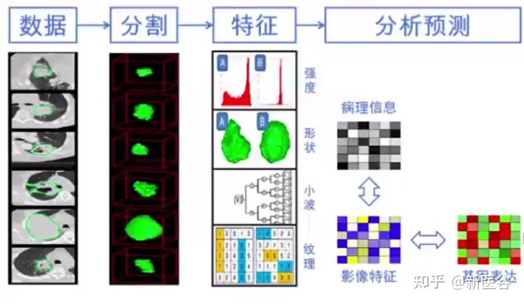 影像时间浅谈影像组学与人工智能