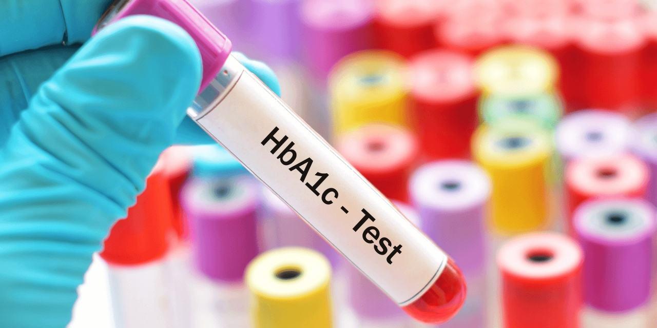 v2-8f9e135fb6062fc5d1baf94a2af376dc_1440w.jpg?source=172ae18b