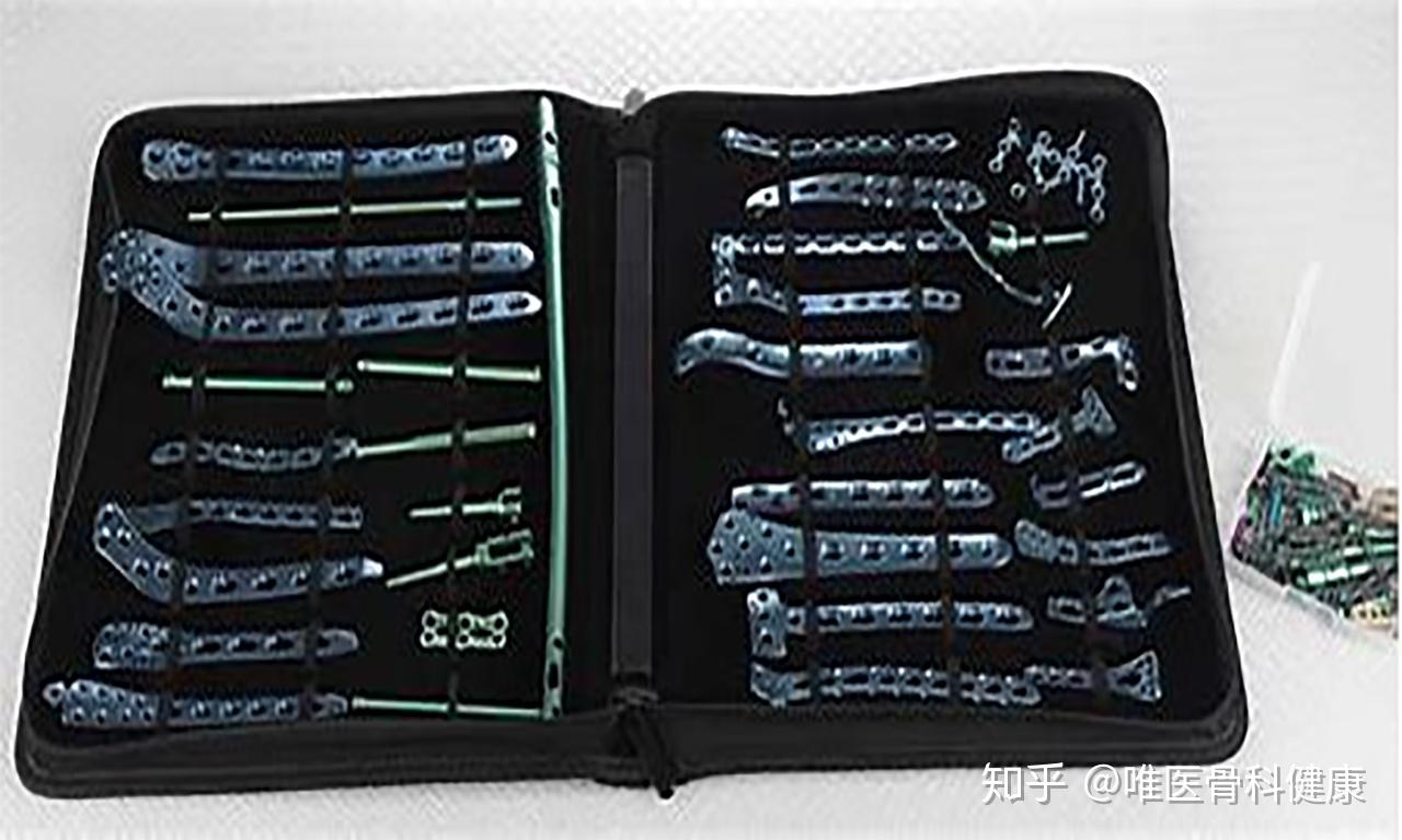 骨折后体内装了钢板坐飞机安检时能通过吗骨科医生这样说