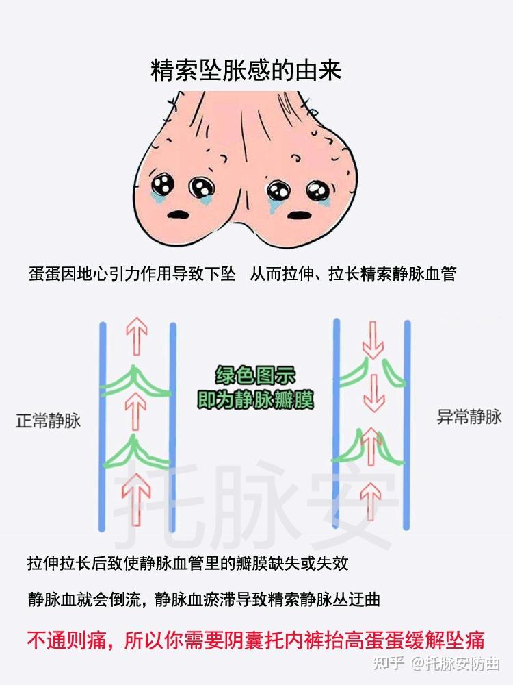 阴囊下坠是什么原因图片