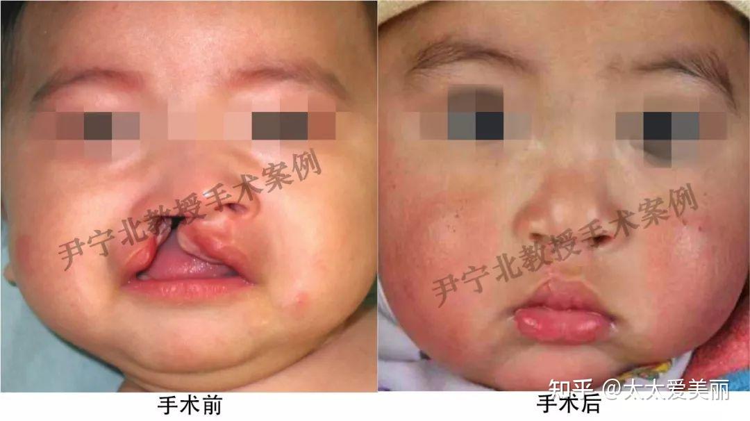 人气整形医生合集2:尹宁北章庆国李发成靳小雷穆大力测评-含唇