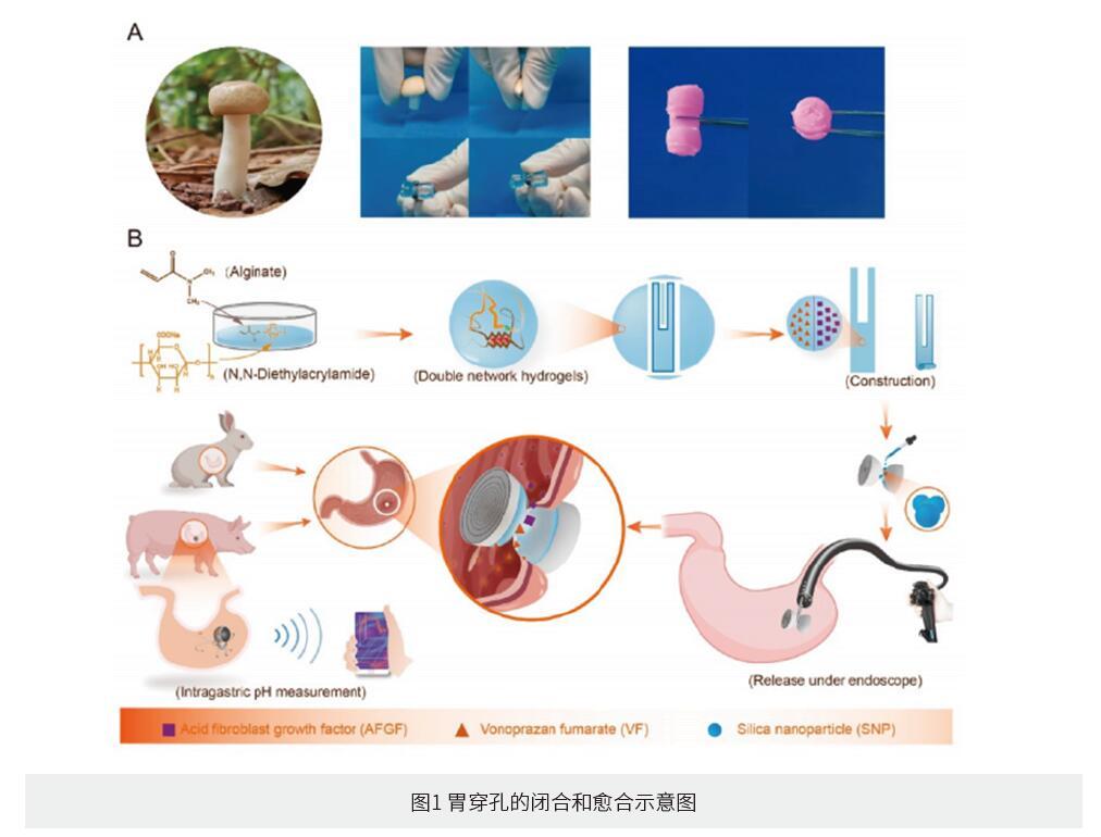 内镜下可递送和蘑菇帽启发的双曲面形载药生物粘附水凝胶用于胃穿孔修复 - 知乎