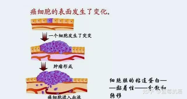 癌细胞是怎么形成的图片