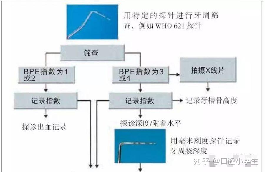 牙周筛查 - 知乎