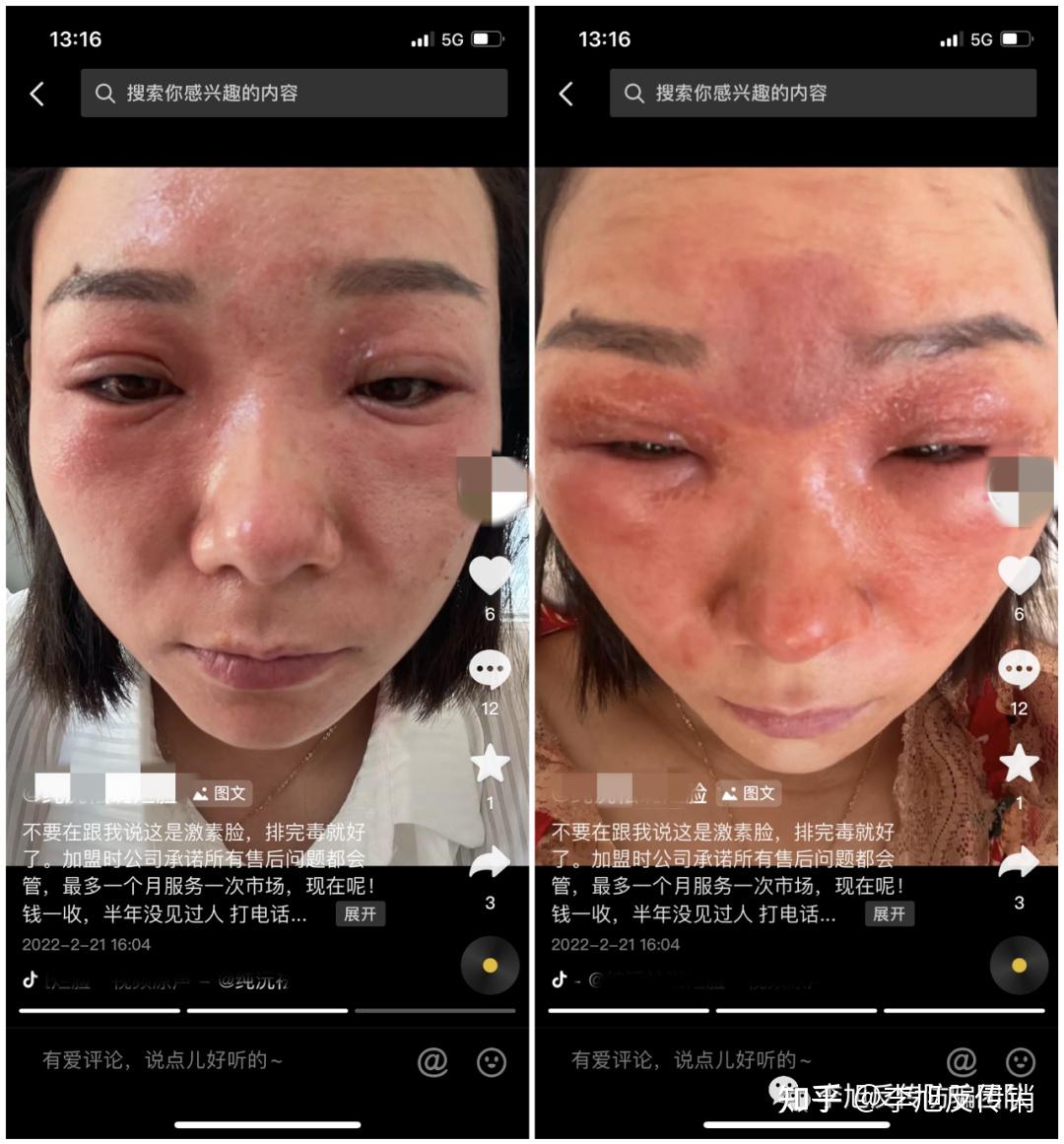 马上购帮扶变拉人头传销骗局纯沅祛斑遭网友质疑