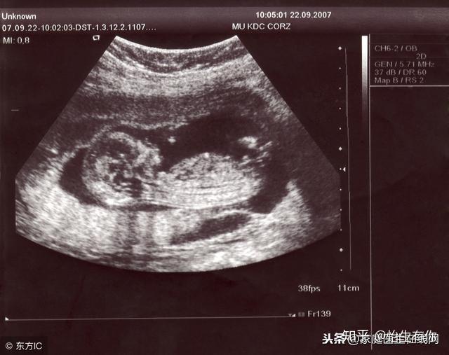 孕妇做四维彩超提前做好4个准备确保结果更准确