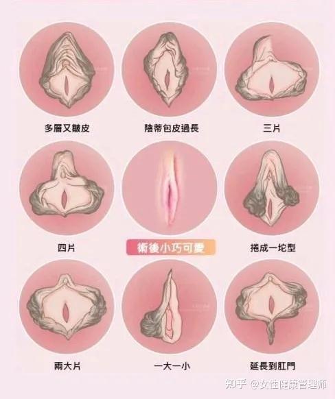 想知道却不好意思咨询羞羞的私密整形来告诉你