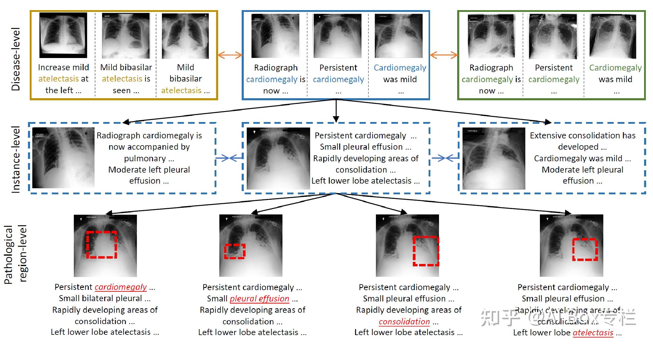 Multimodality in Medical Domain：一文速览医学多模态进展 - 知乎