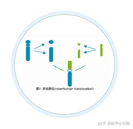 染色体罗氏易位 - 知乎