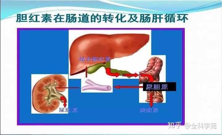 从症状谈疾病系列——黄疸 - 知乎