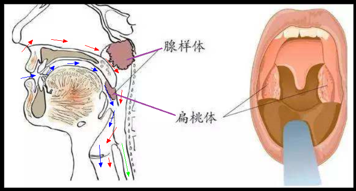 十个月宝宝晚上睡觉鼻子不通气_宝宝晚上睡觉鼻子不通气小妙招_睡觉鼻子不通气小妙招