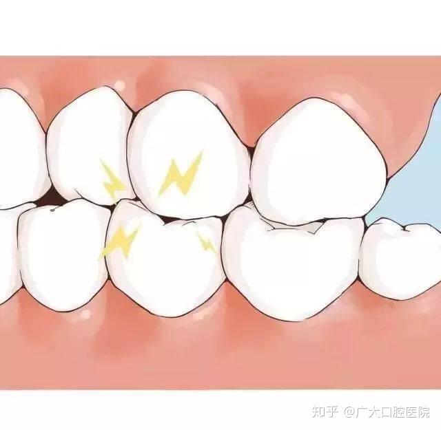 牙关在哪里图片图片