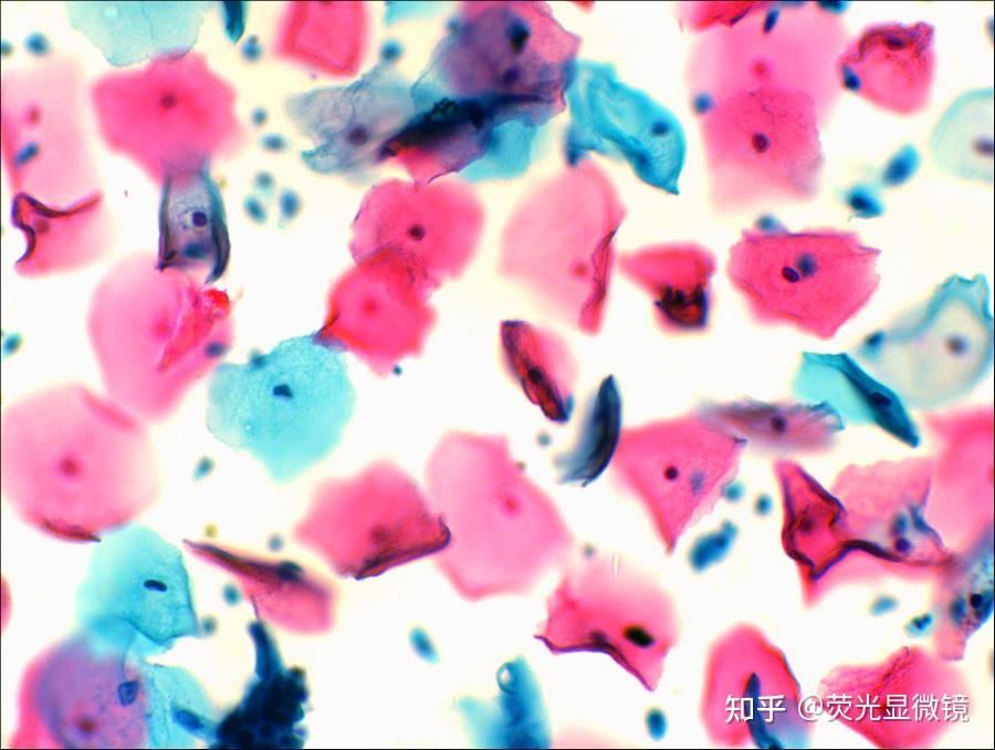 显微成像中的tct薄层液基细胞学检查