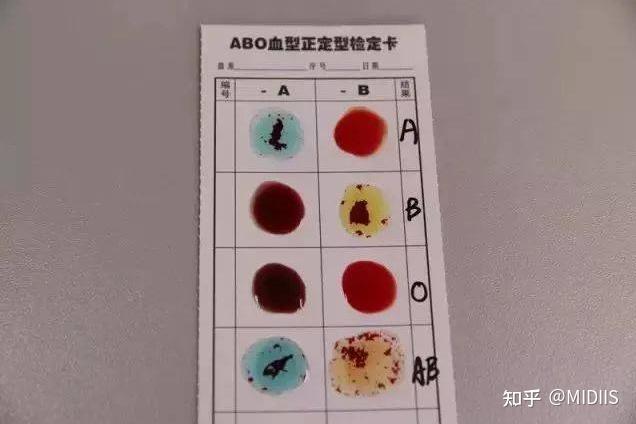 你知道什么是血型吗血型篇