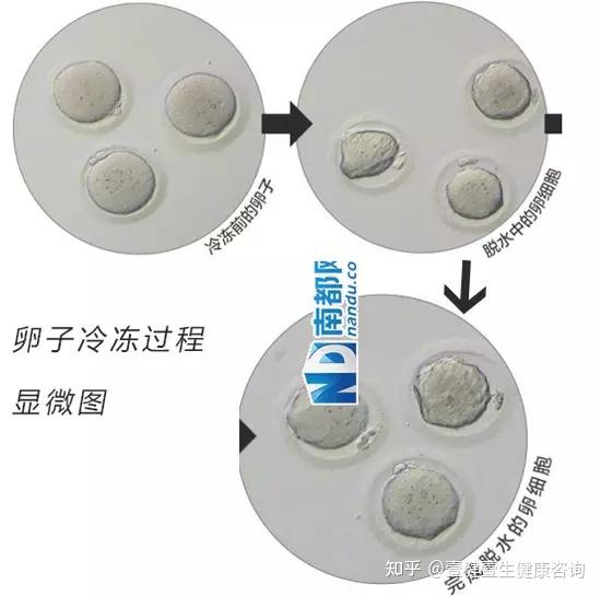 美国辅助生殖协会公布的《成熟卵母细胞冷冻指南》中总结到,鉴于过去