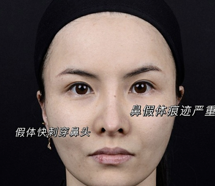 v2-9258fab81d05fb66bc2443bce3c23ea3_1440w.jpg?source=172ae18b