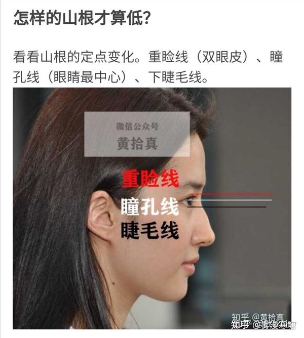 鼻子高但是山根低是什么样