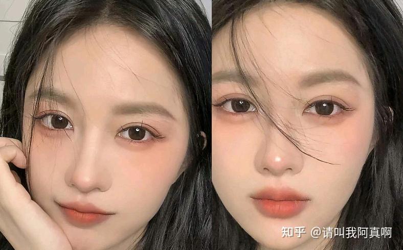 合肥双眼皮医生和医院哪些做自然风格比较好